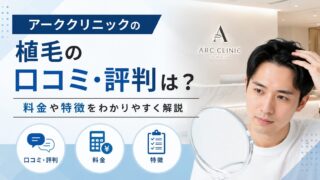 AGA by Ark CLINIC（アーククリニック）植毛の口コミ・評判｜料金も解説 